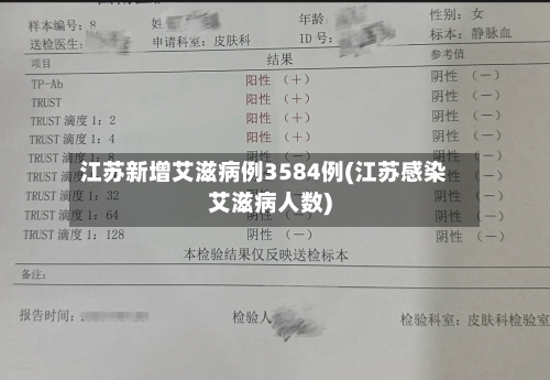江苏新增艾滋病例3584例(江苏感染艾滋病人数)-第2张图片